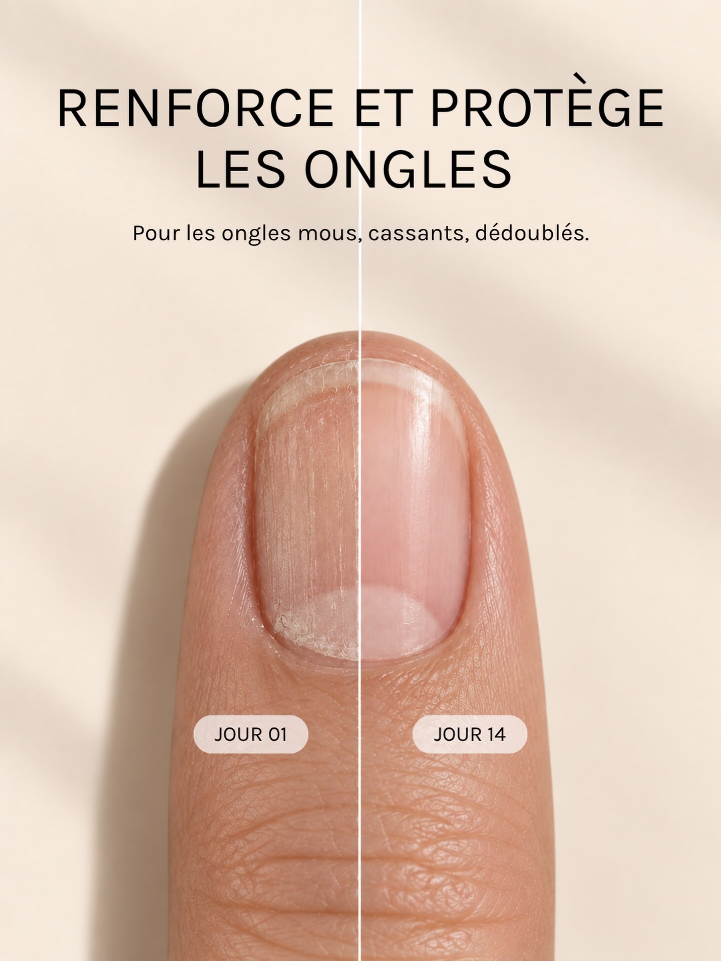 Ongles mous, cassants ou dédoublés ?
 
Onycare est un sérum concentré conçu pour renforcer et protéger les ongles fragilisés.
 
Sa formule associe des extraits végétaux et des huiles essentielles de Citron et de Myrrhe pour aider les ongles à retrouver force, souplesse et vitalité.
 
Appliquez 1 à 2 gouttes sur l’ongle nu et sa base, puis massez délicatement. À utiliser régulièrement en cure de plusieurs semaines.
 
Retrouvez Onycare sur notre site www.cinier-b.com.
 
#cinierb #onycare #soindesongles #onglesfragiles #soinnaturel